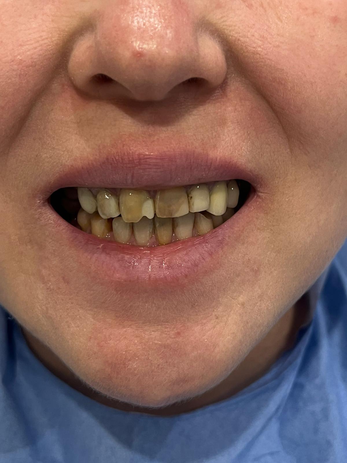 ECE Dental Patient Transformation